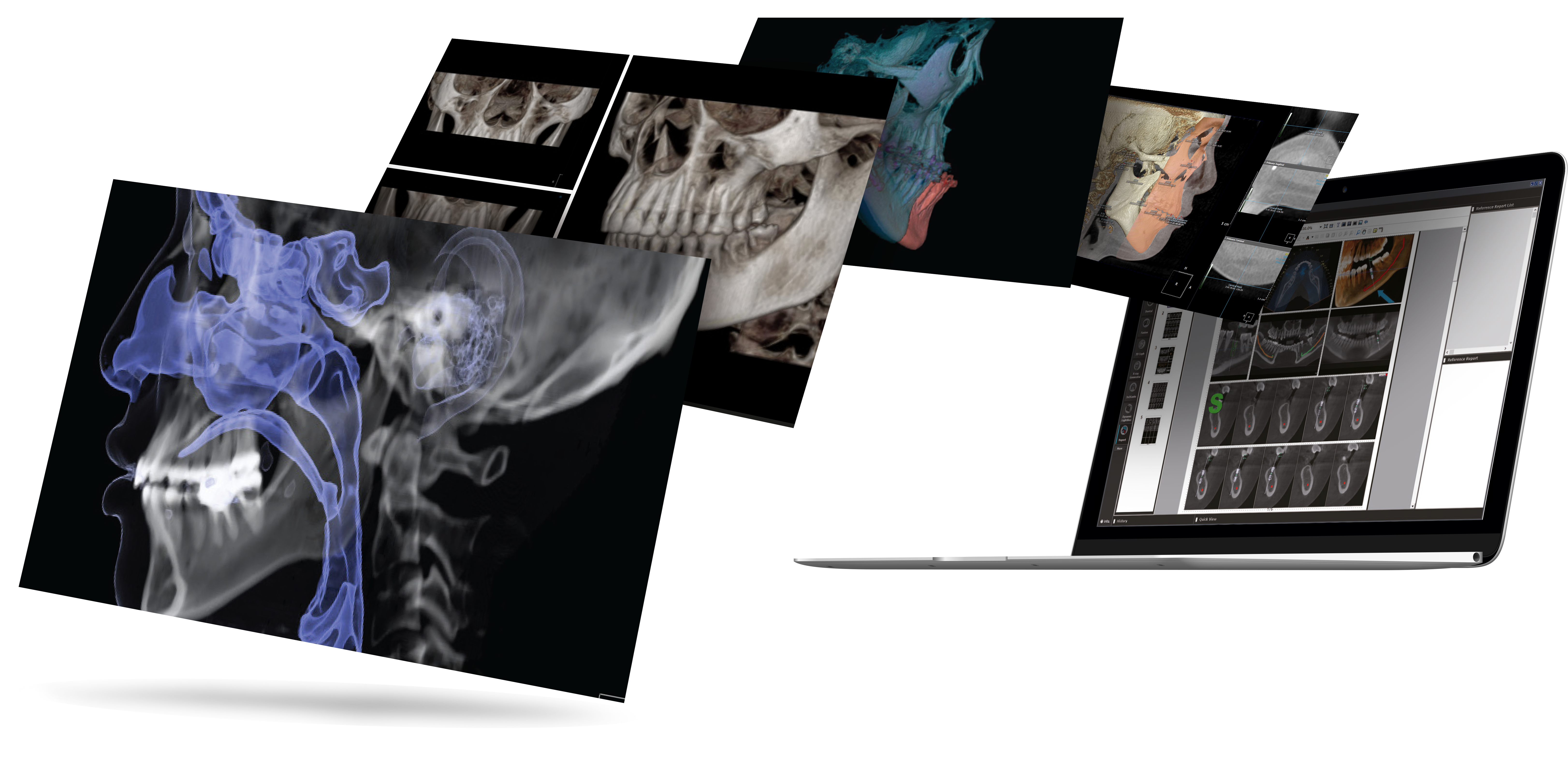 OnDemand3D MacBook_2.png