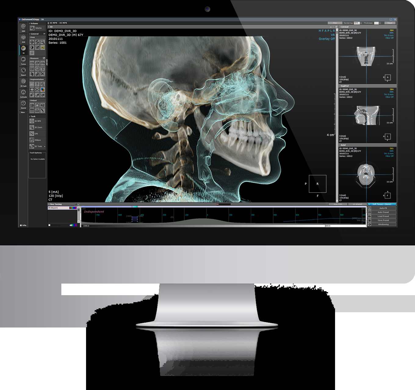 OnDemand3D (3D 이미징 소프트웨어)