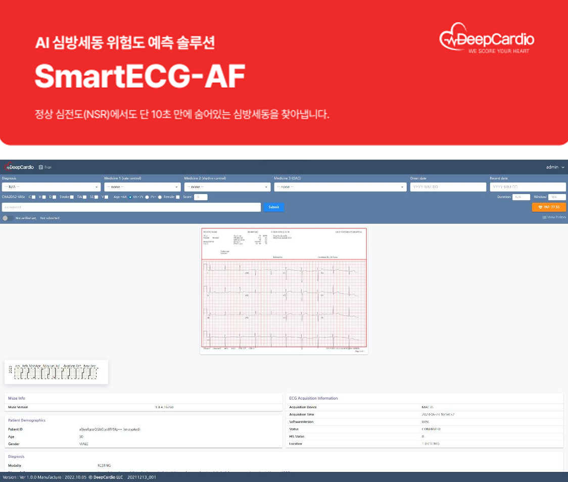 SmartECG-AF